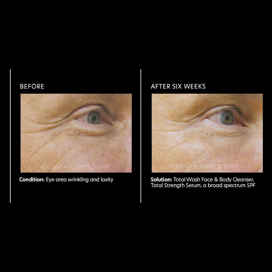 PCA Skin Total Strength Serum 1 fl oz - results