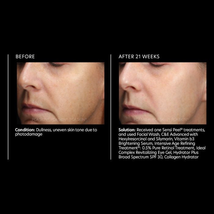 PCA Skin Vitamin b3 Brightening Serum 1 fl oz - results