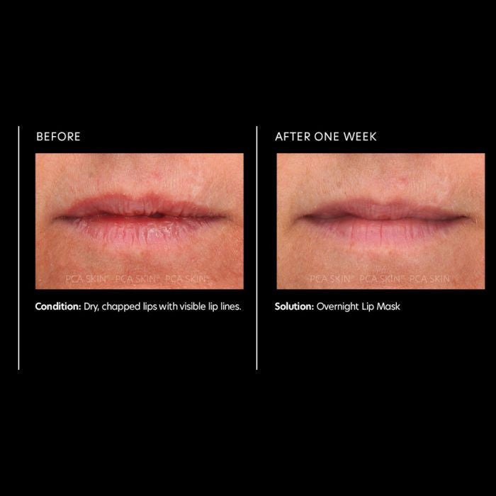 PCA Skin Overnight Lip Mask 0.46 oz - results