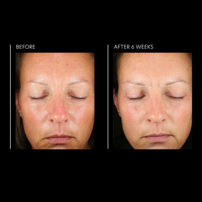 PCA Skin Hyaluronic Acid Overnight Mask 1.8 oz - results 1