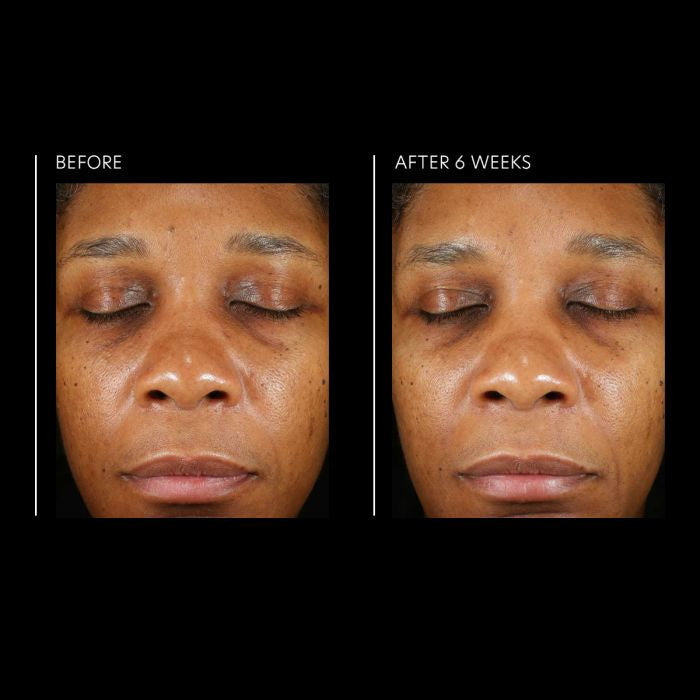 PCA Skin Hyaluronic Acid Overnight Mask 1.8 oz - results 2