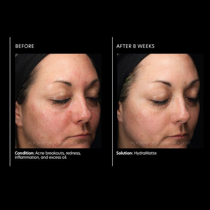 PCA Skin HydraMatte 1.8 fl oz - results