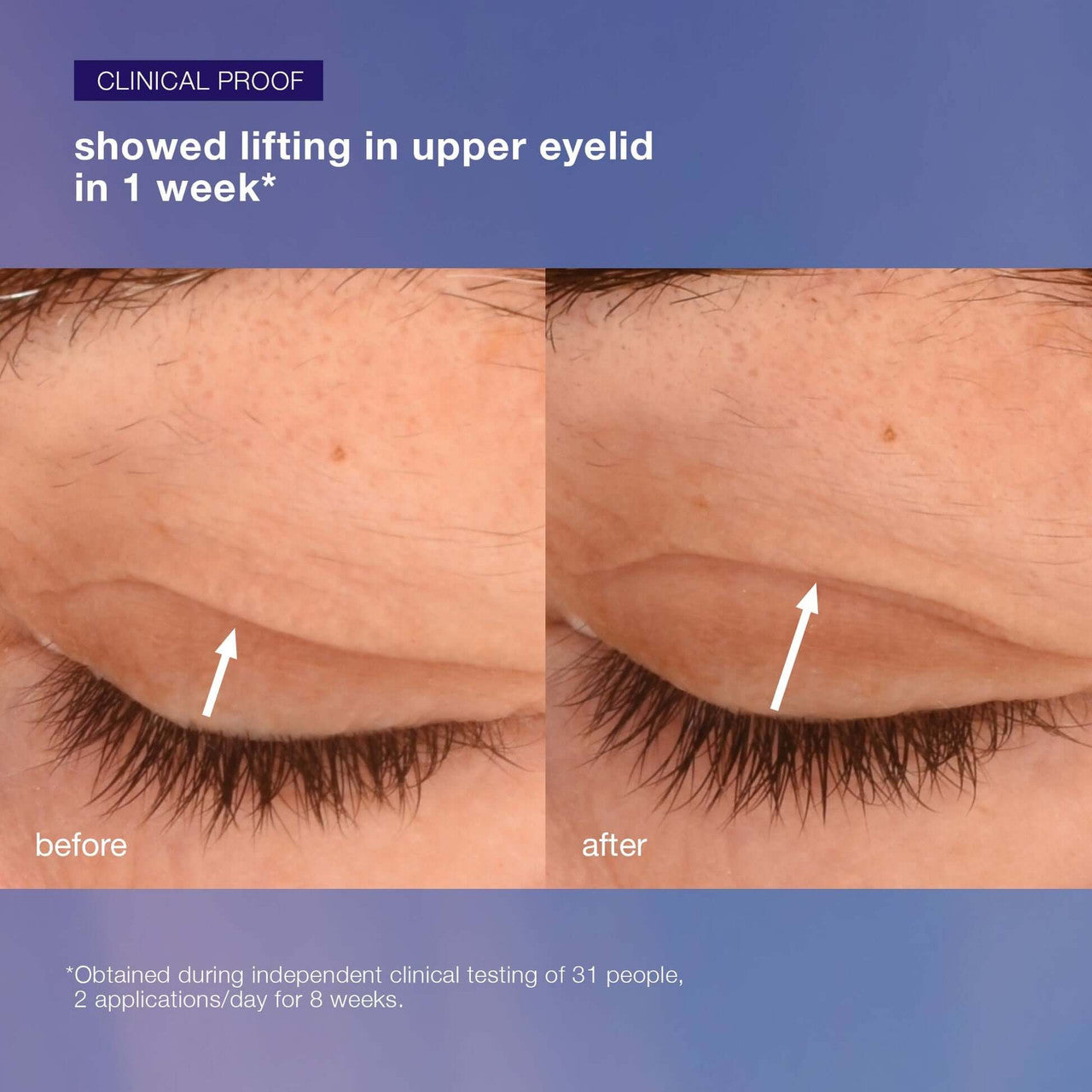 Dermalogica Phyto Nature Lifting Eye Cream 0.5 oz - SkinElite - before and after