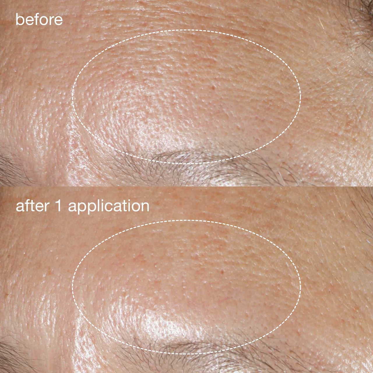 Dermalogica Phyto Nature Oxygen Cream 1.7 oz - SkinElite - before and after