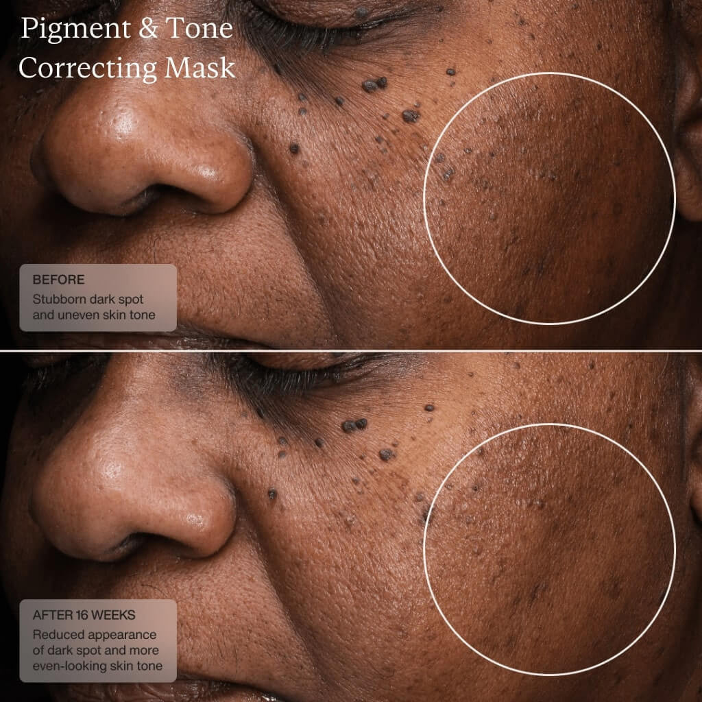 Senté Pigment & Tone Correcting Mask 1.7 fl oz - SkinElite - before and after 4