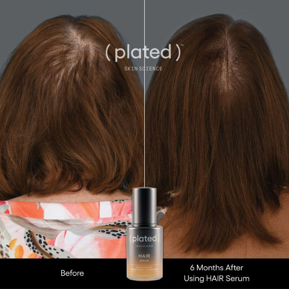 ( plated ) Skin Science HAIR Serum women before and after - SkinElite