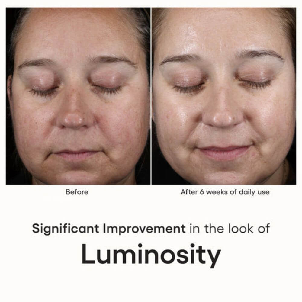 ( plated ) Skin Science INTENSE Serum Duo before and after - SkinElite