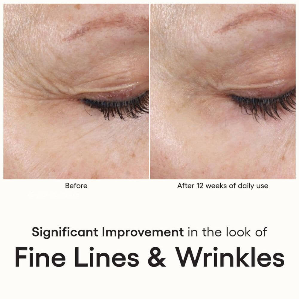 ( plated ) Skin Science INTENSE Serum fine lines and wrinkles - SkinElite