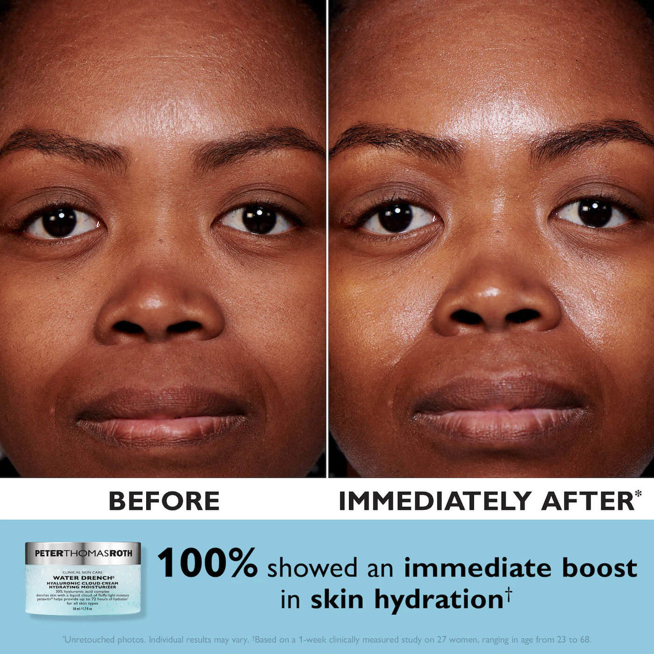 Peter Thomas Roth Full-Size Day & Night Cloud Creams 2-Piece Kit - Skin Elite - Cloud Cream Clinical Results