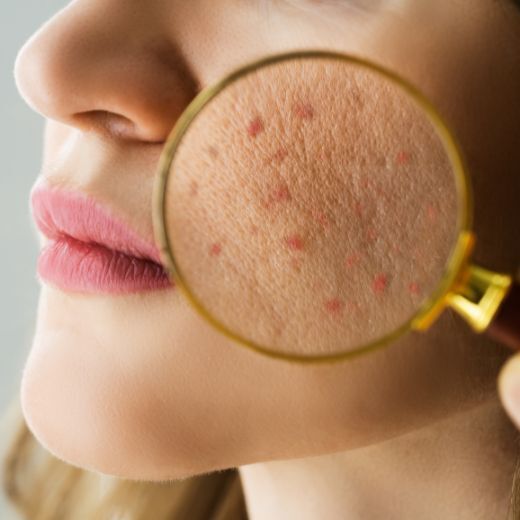 Identifying skin type