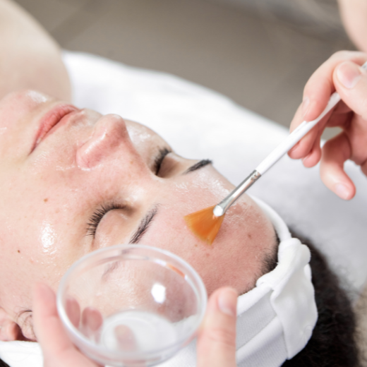 at home skin peels