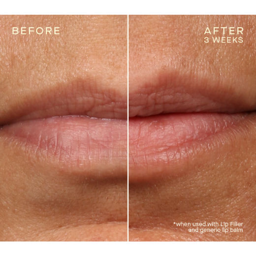 Ourself lip conditioner before/after results