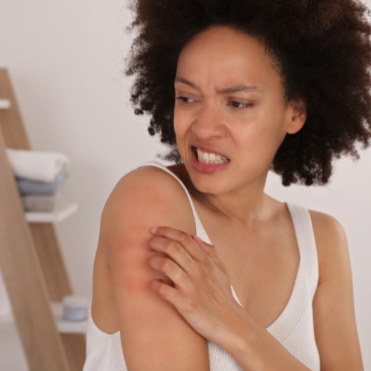 Woman finding skin allergy symptoms on her arm in the form of a rash