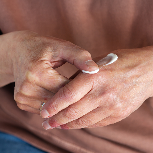 Woman applying cream to hands to calm irritated skin from allergies