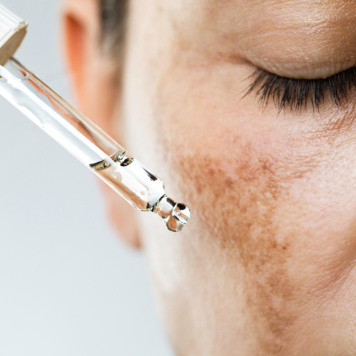 Professional Skin Treatments